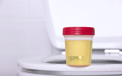 Необходимые предметы для анализа - Квинмед